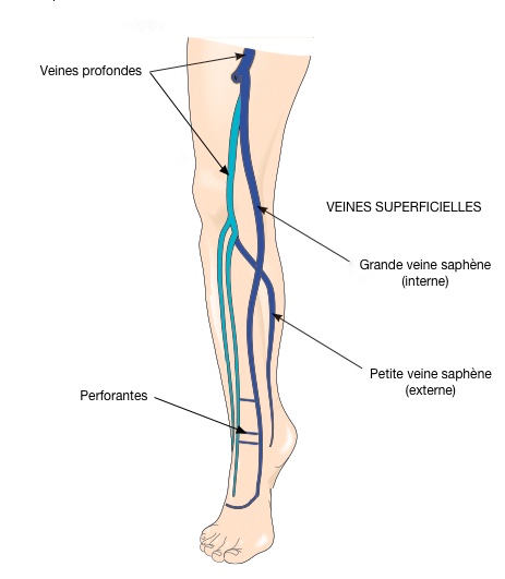 varices internes jambes symptômes